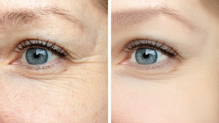 Anti Aging Behandlung Wien