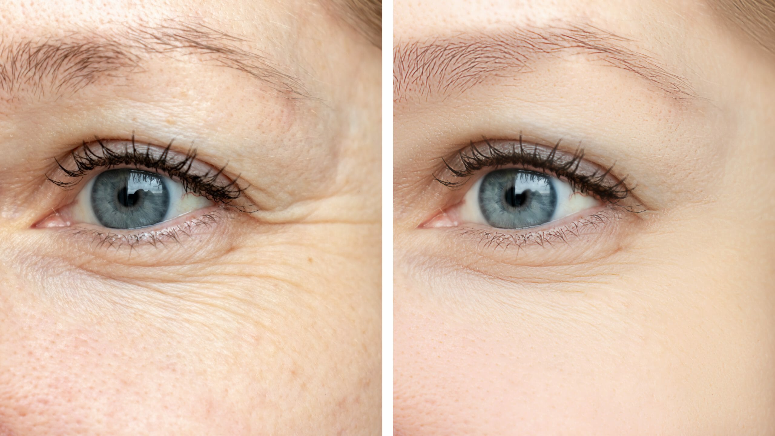 Anti Aging Behandlung Wien