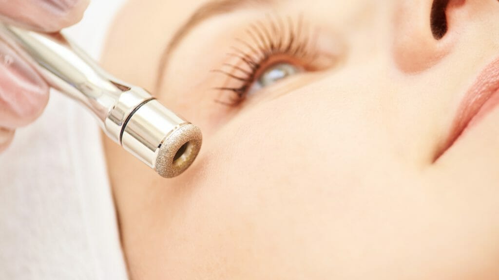 Diamant Microdermabrasion