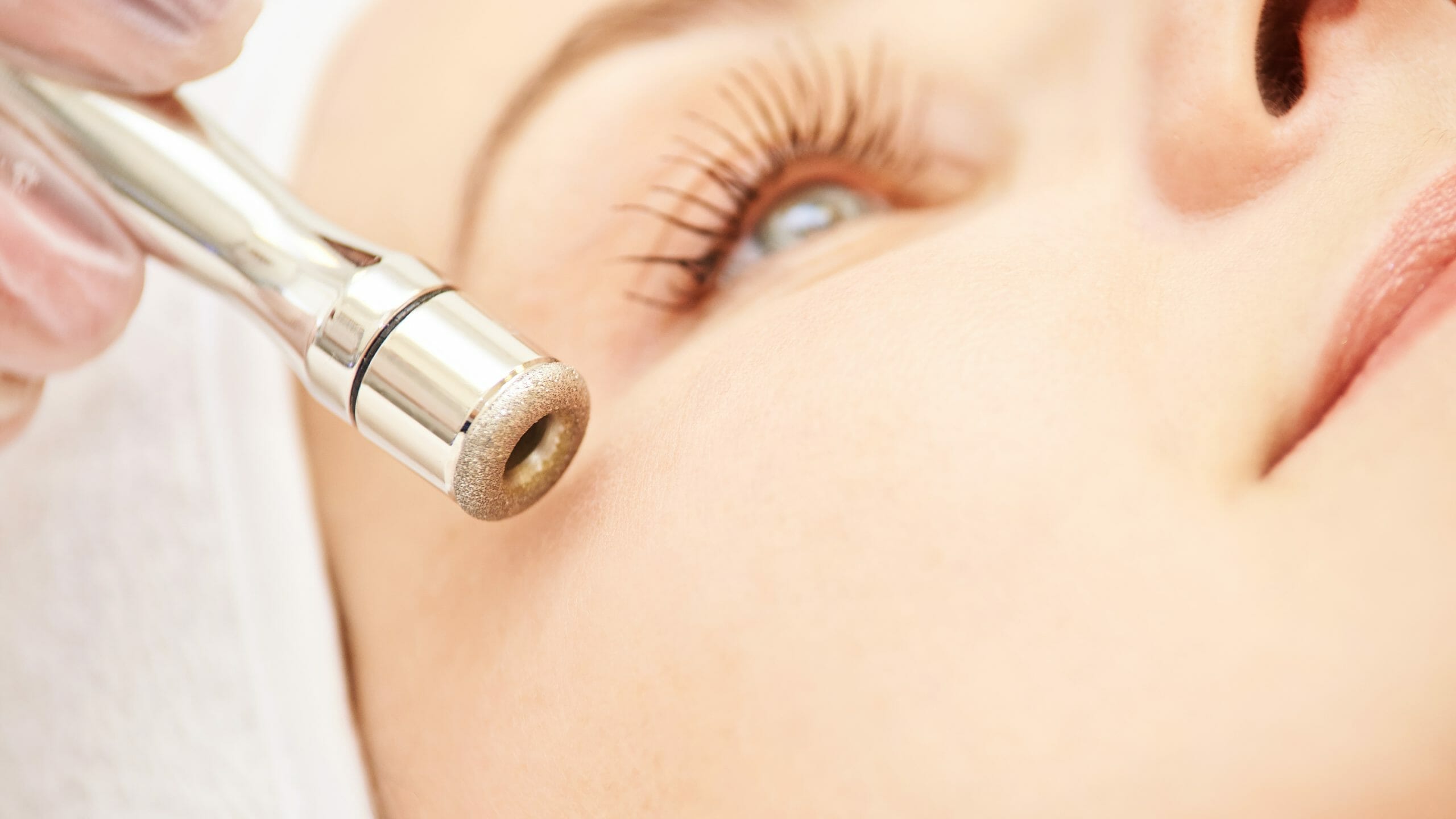 Diamant Microdermabrasion