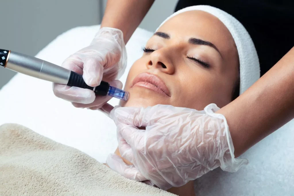 fc3d0aba2fddaff93d3292b54e2b8229.cosmetologist making mesotherapy injection with dermapen on face for rejuvenation on the spa center 1536x1024 1