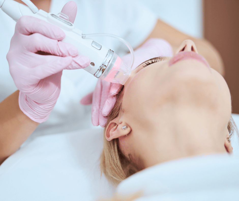 rf needling-2