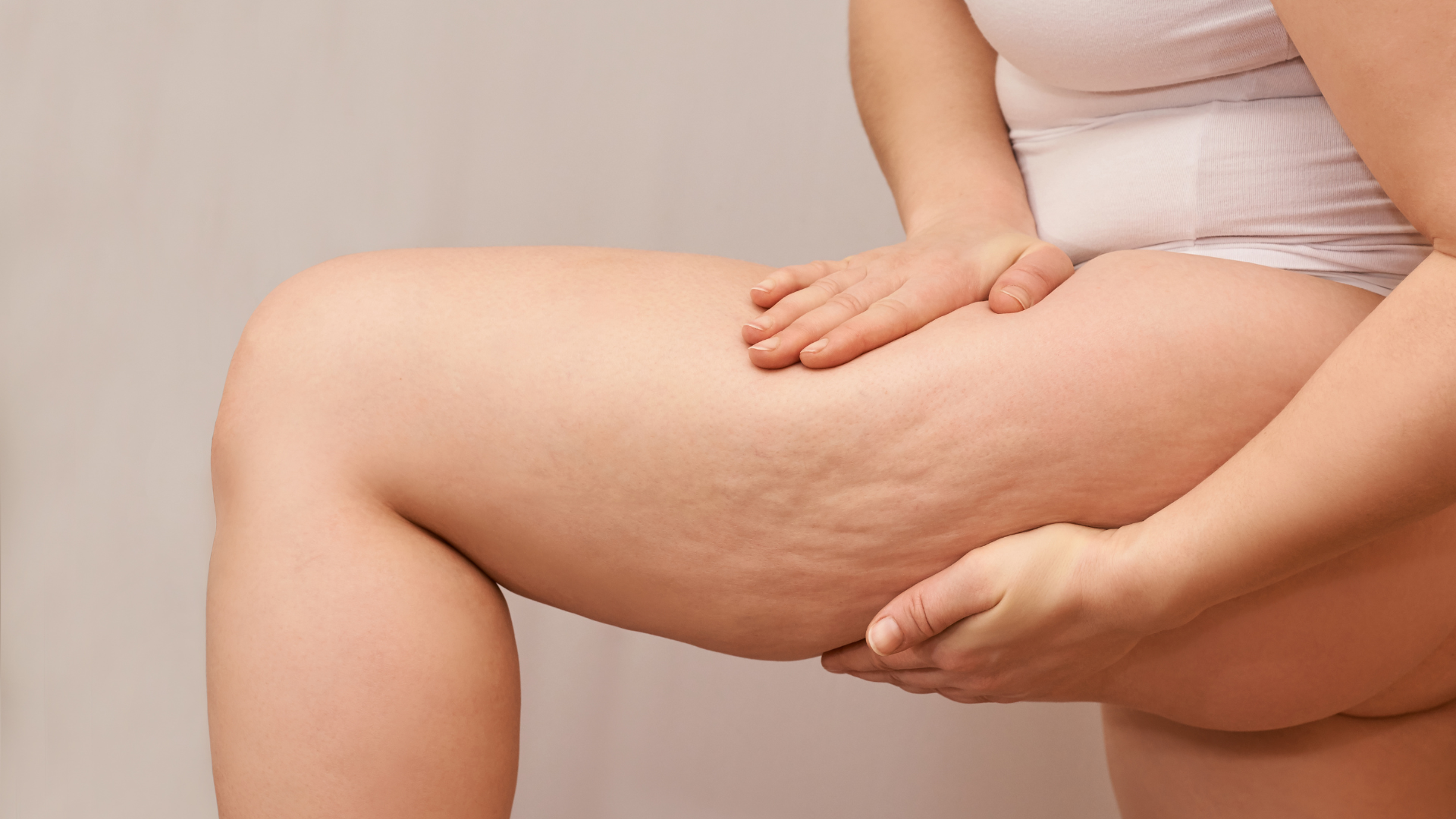 Cellulite behandeln