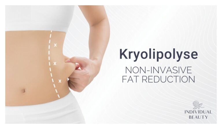 Kryolipolye non invasive