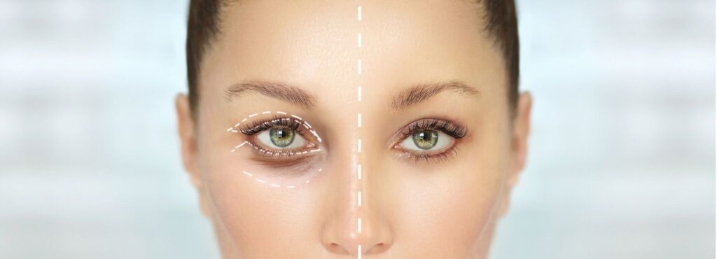 eyelif cover