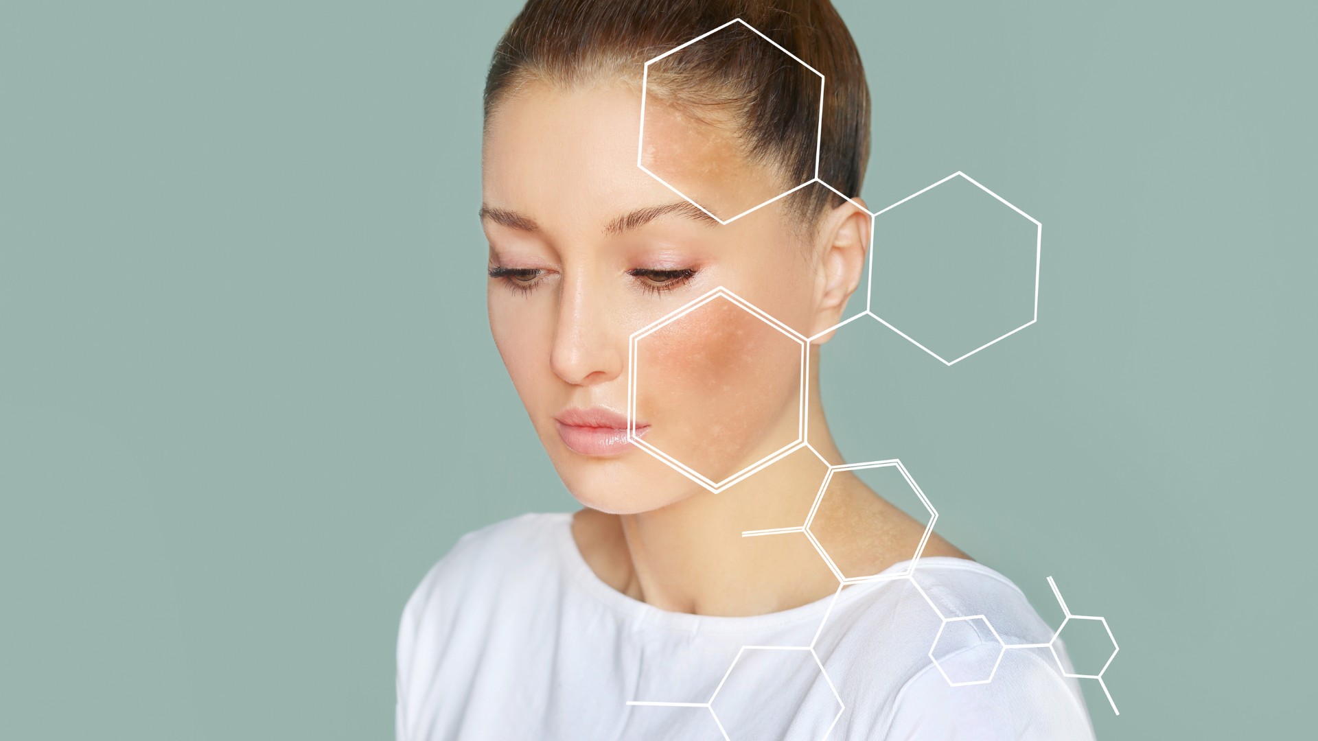 Hautanalyse bei Individual Beauty