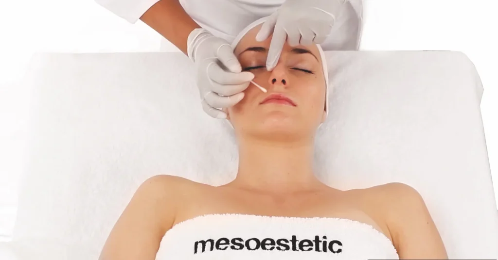 Mesopeel