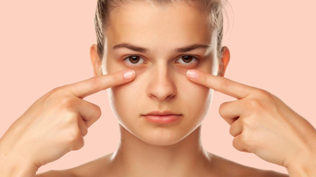 eyes dark circles