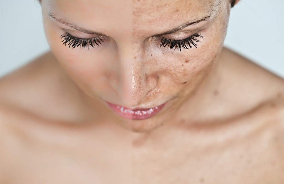 mesoestetic product types 1