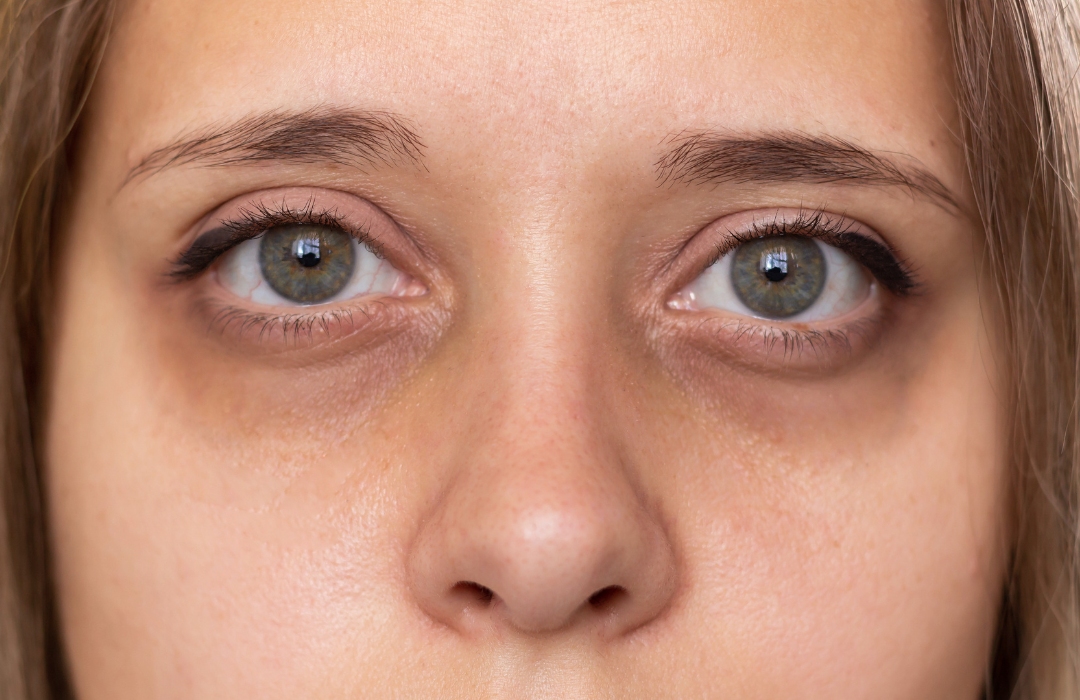 mesoestetic product types 8