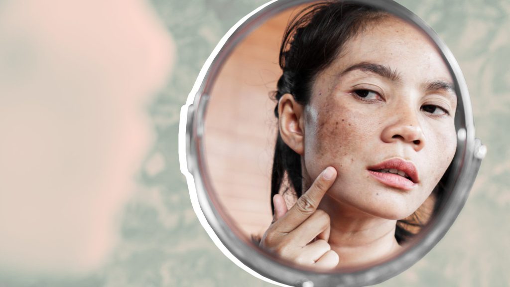 skin spot