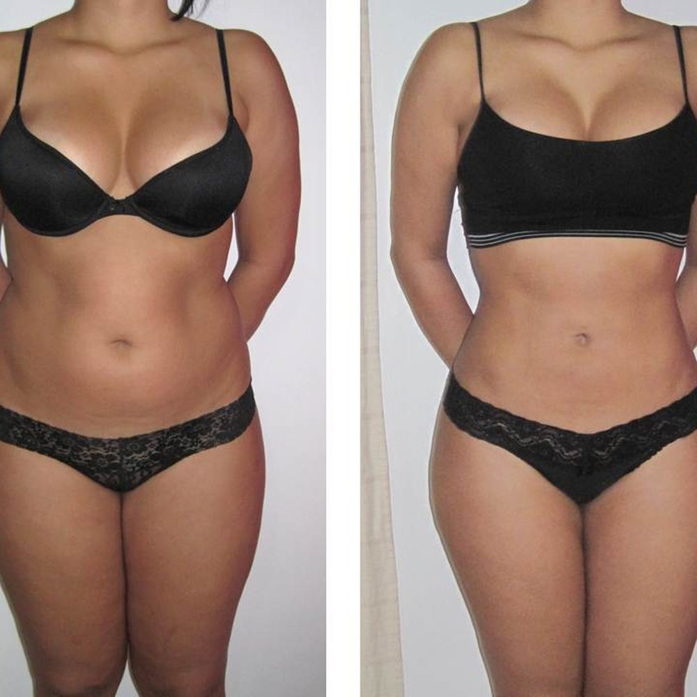 md sculpt before after wien