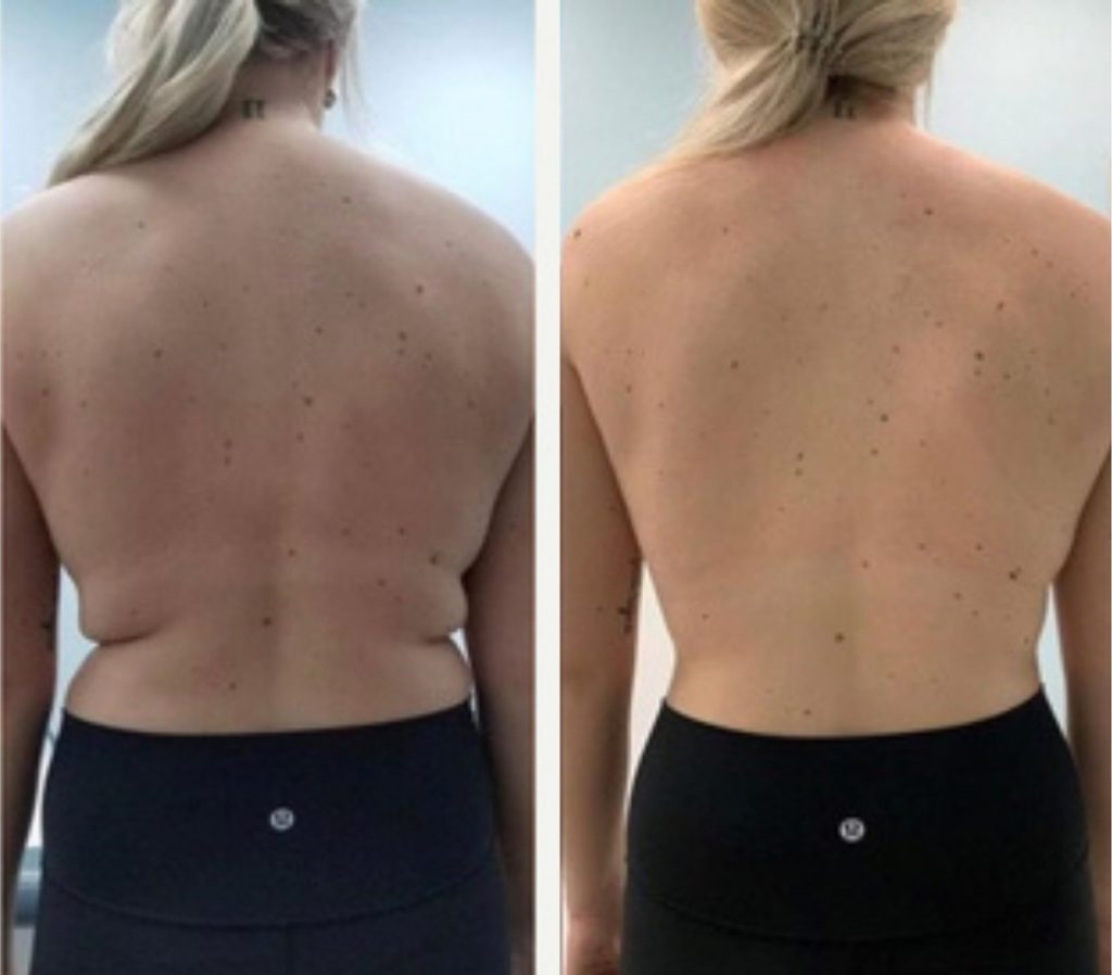 md sculpt before after vienna