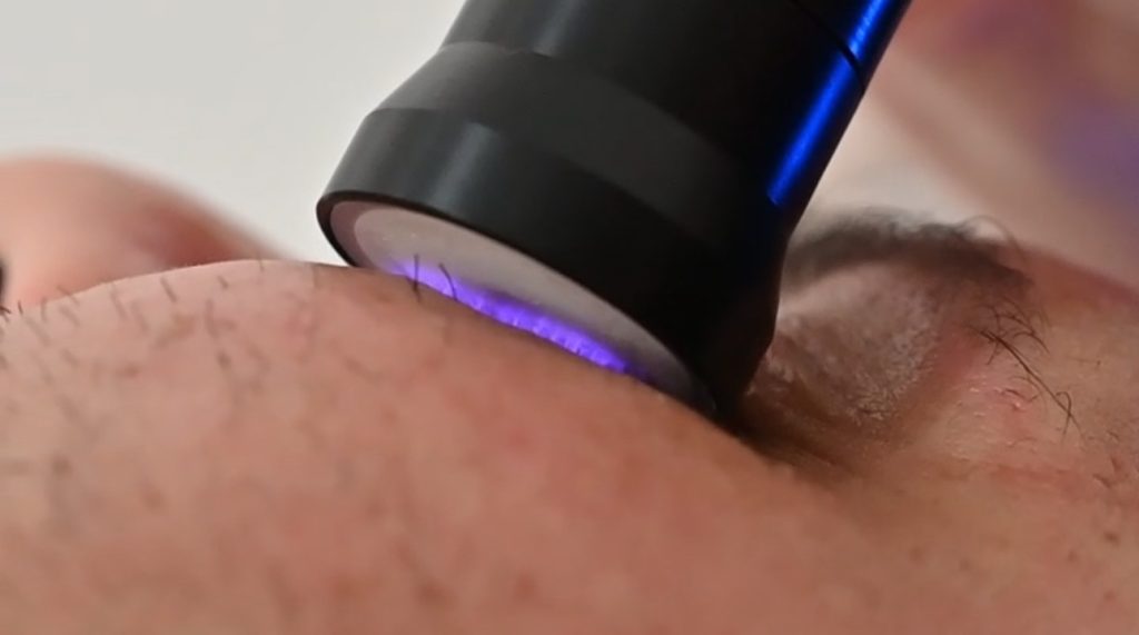 a close up of a person's skin