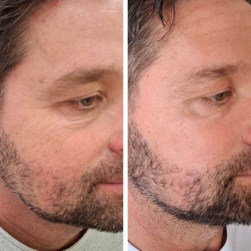 a man with a beard
