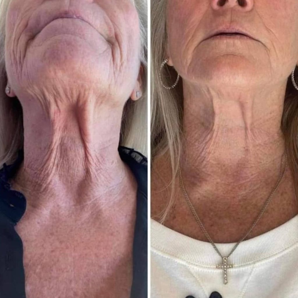 a collage of a woman's neck and neck
