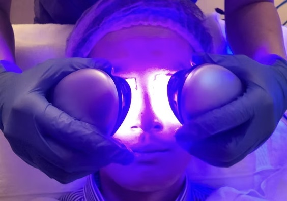 Hydrafacial wien