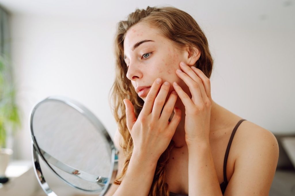 dry skin in winter moisturizing treatments