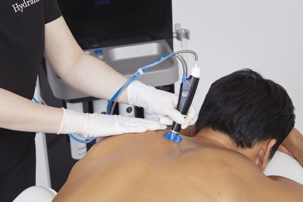 Rückenbehandlung Hydrafacial Männer