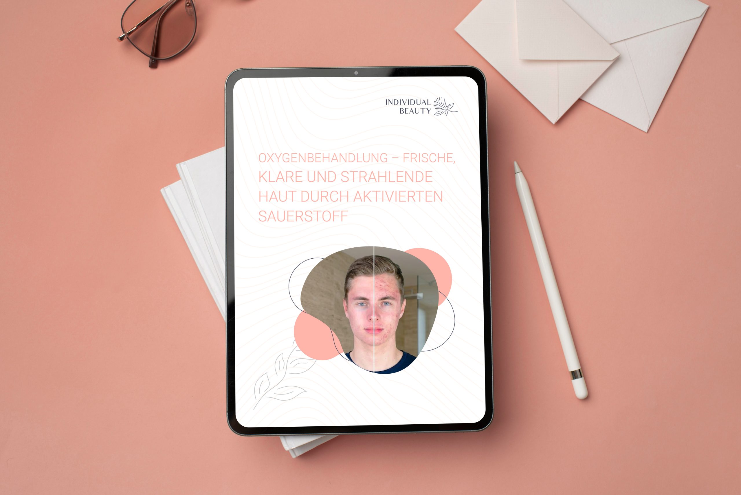 Oxygenbehandlung eBook Mockup scaled