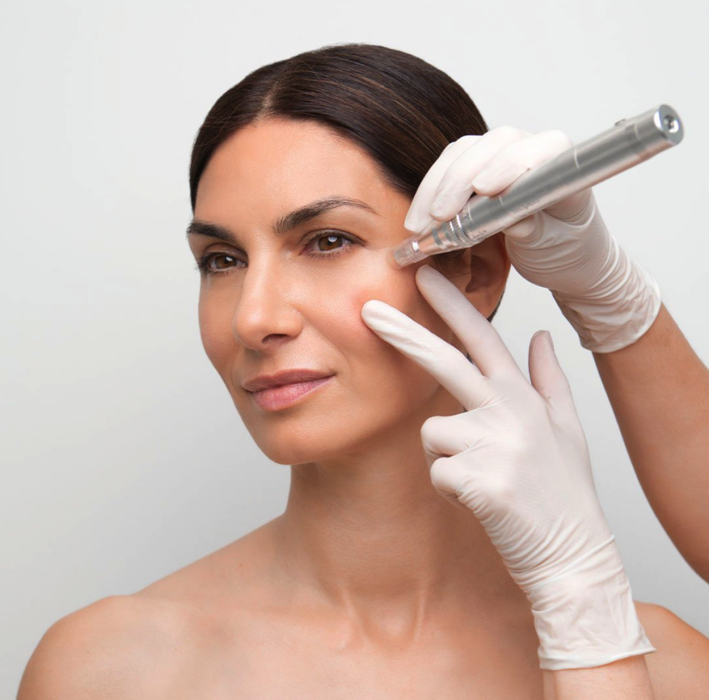 medical microneedling