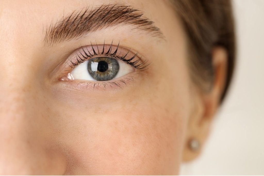 Brow Lifting