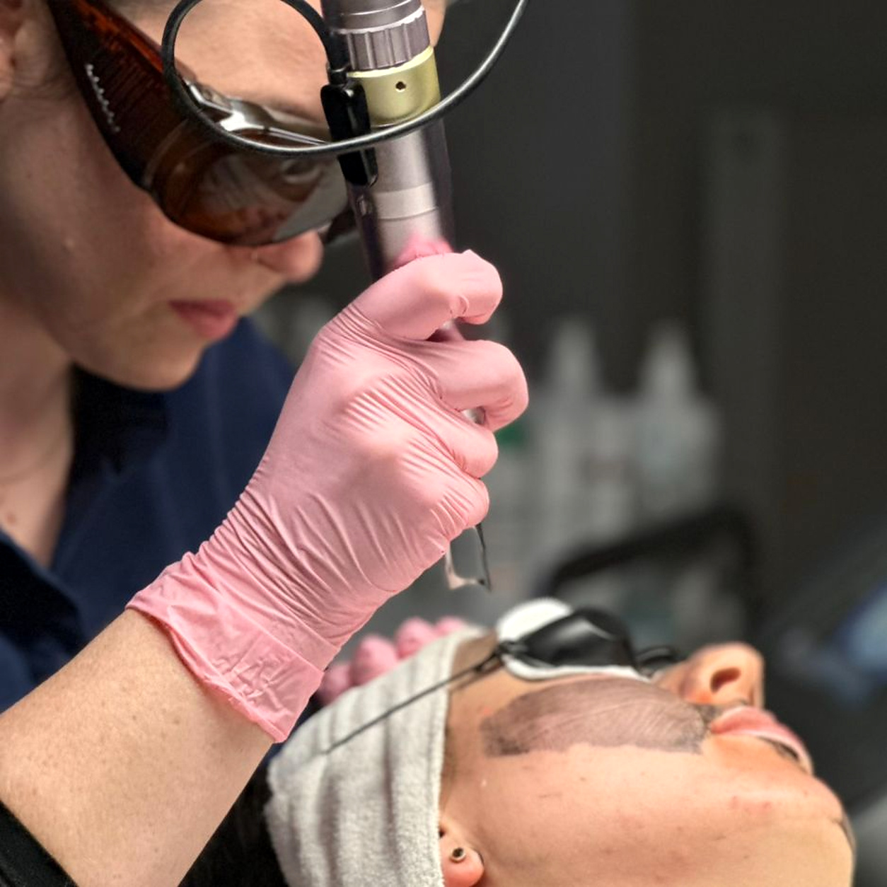 Carbon Laser Hollywood Peeling bei Individual Beauty