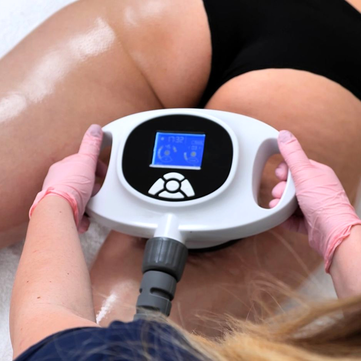 Cellushape bei Cellulite und Körperstraffung bei Individual Beauty