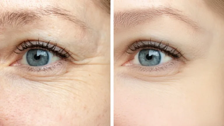 Anti Aging Behandlung Wien