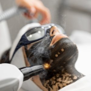 carbon peeling
