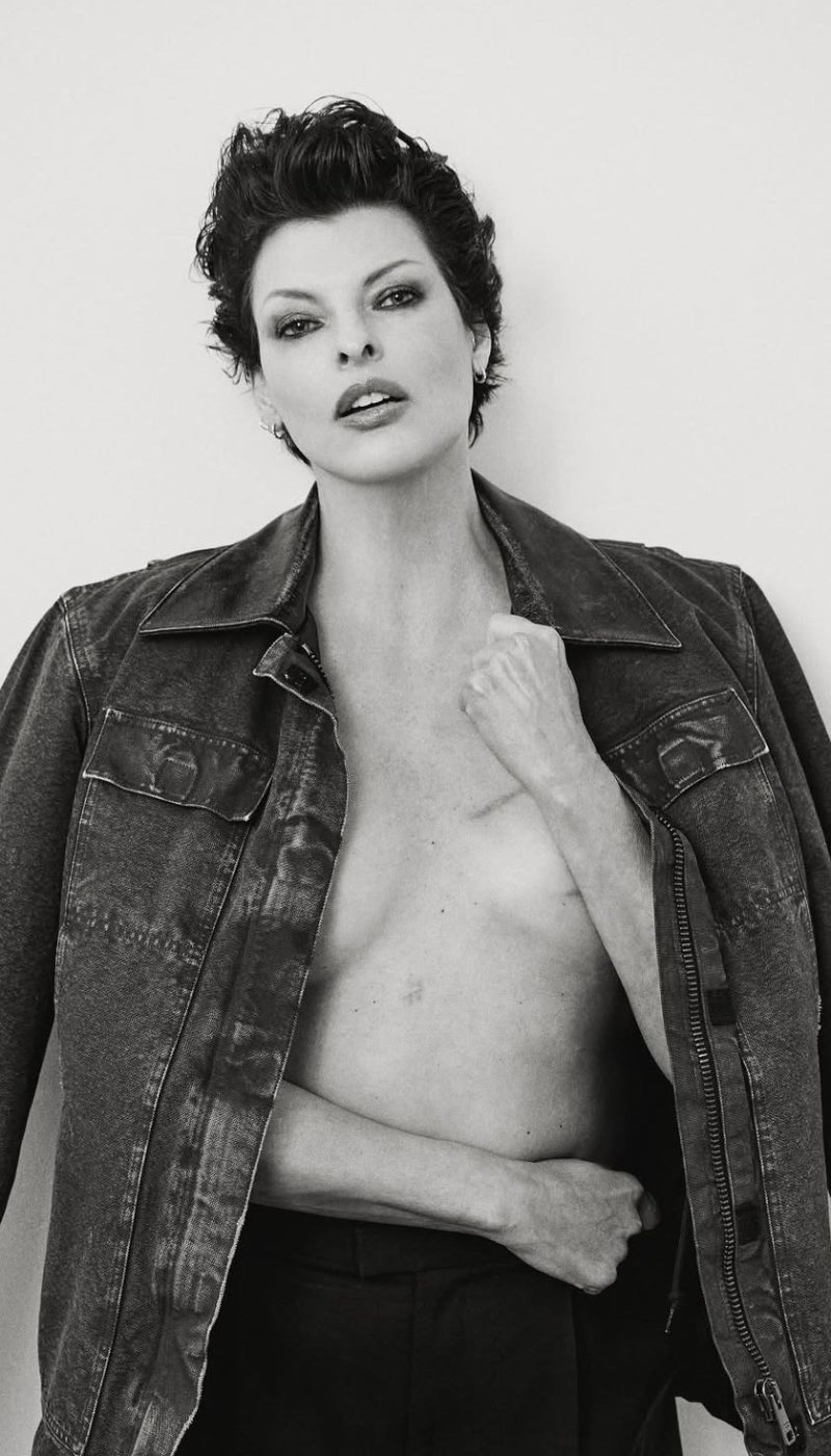 Coolsculpting Linda Evangelista
