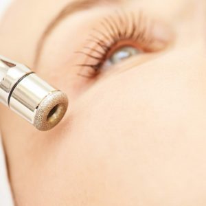 Diamant Microdermabrasion