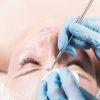 Tiefenreinigung mit Fruchtsäurepeeling (60 Min) 