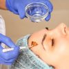 Retinol-Peeling