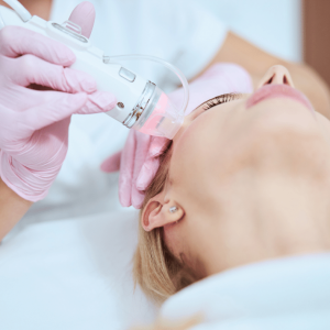 rf needling-2